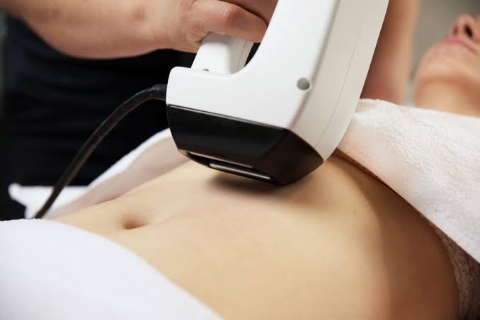 Thermage Body เหมาะกับคนหลังคลอดหรือไม่?