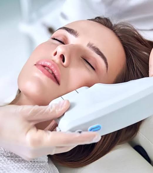Ultherapy Prime